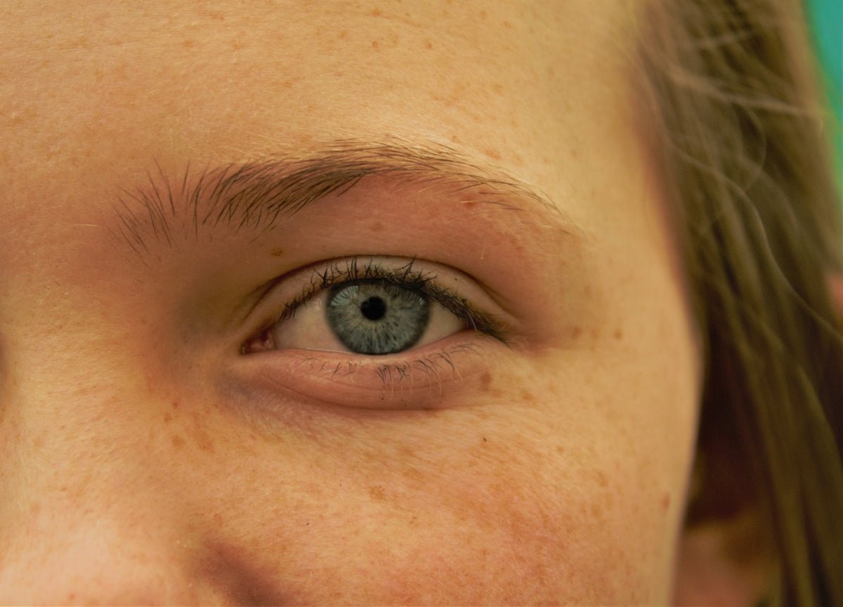 10 Ways Eye Mask Skincare Transforms Dark Circles - Kenzina