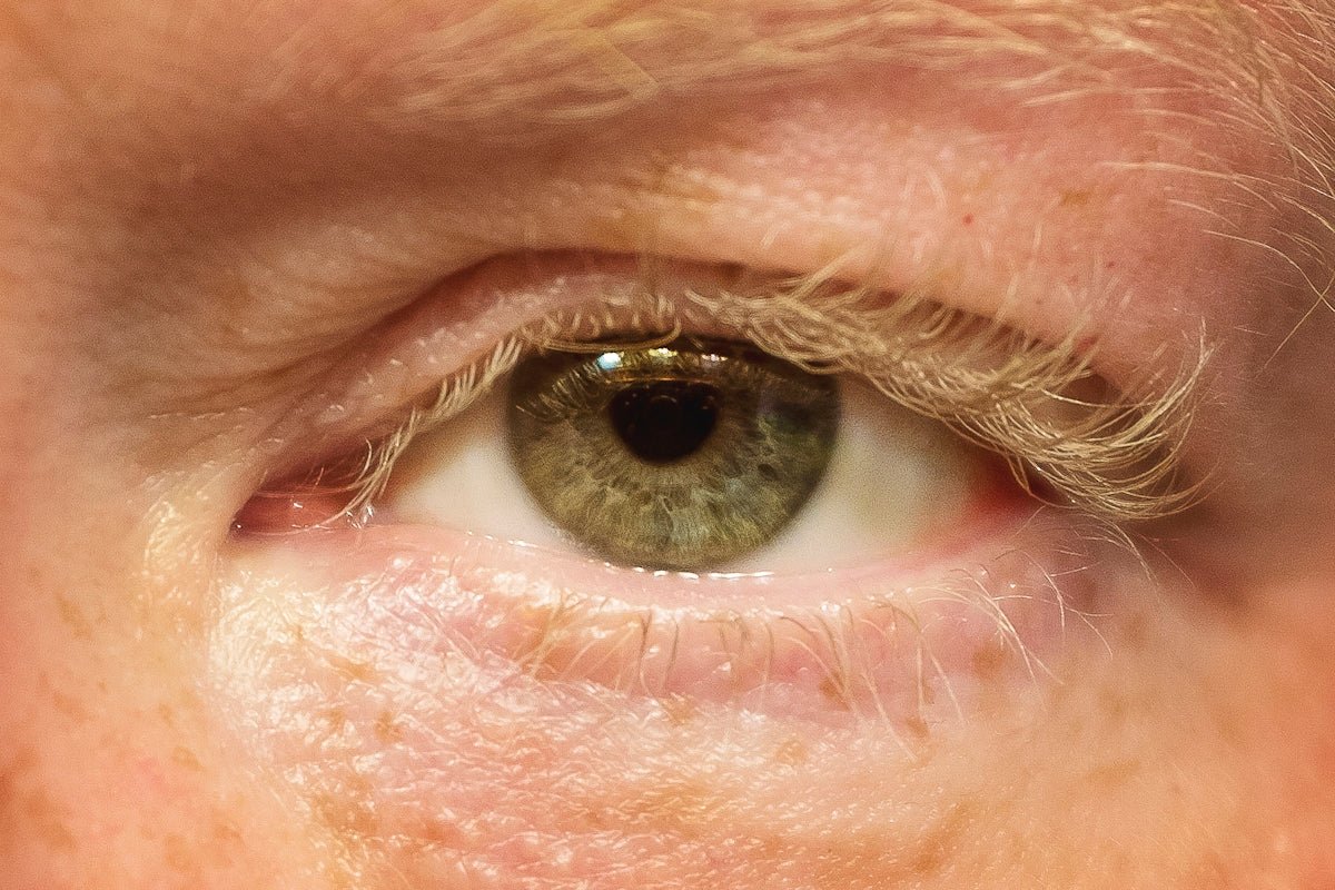 Rejuvenate Weary Eyes With Natural Puffiness Remedies - Kenzina