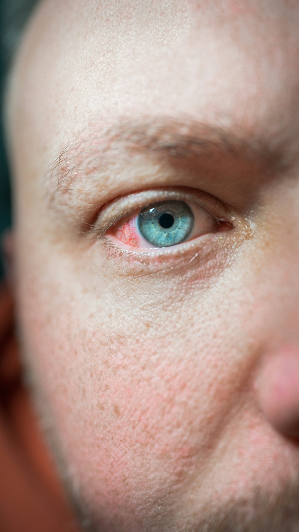 a close up of a person with blue eyes