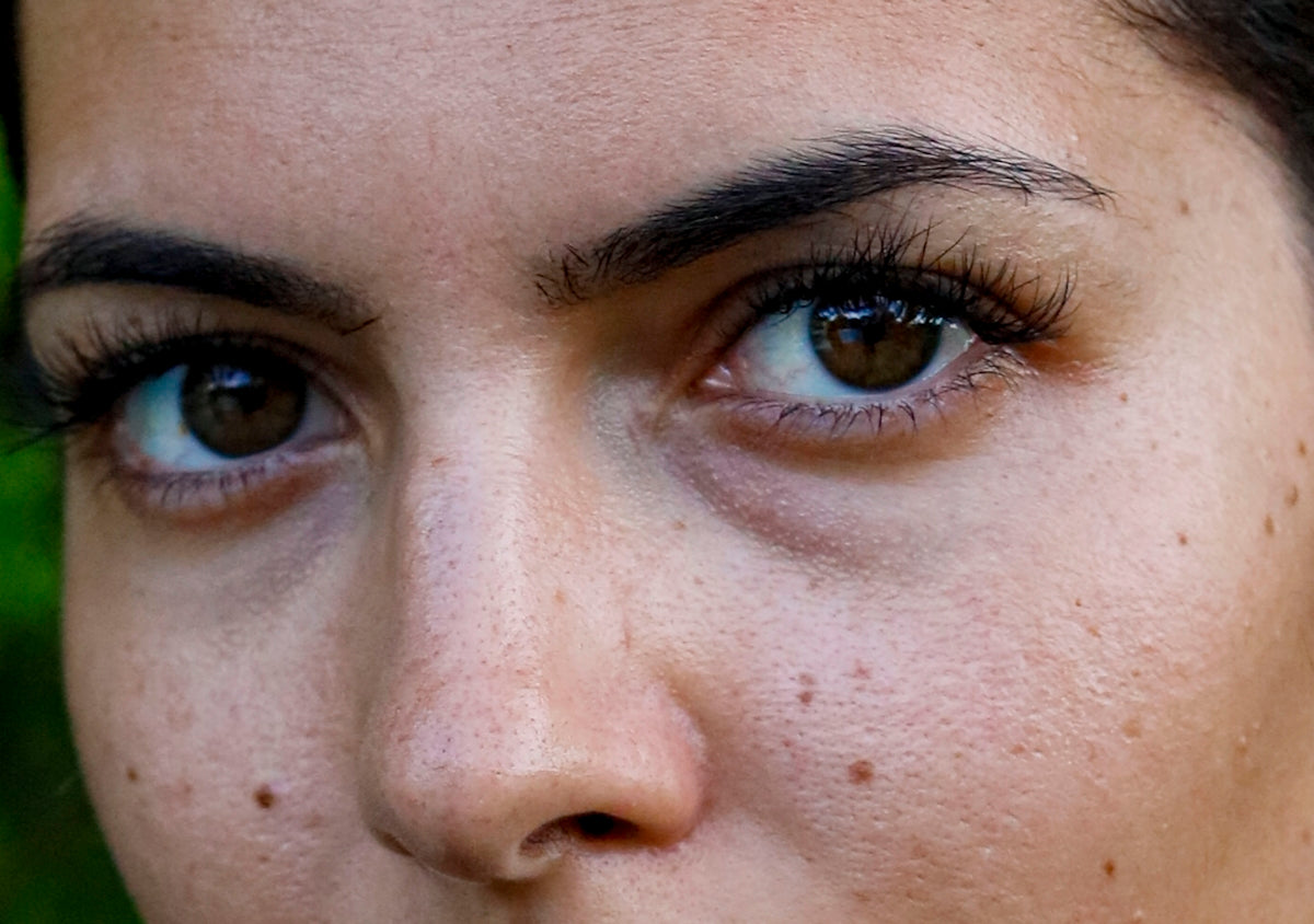 A close up of a woman with freckles on her face